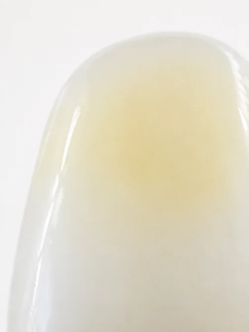 Crown photo — cervical-to-incisal shade gradient