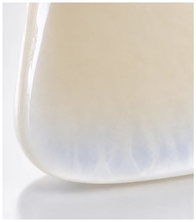 Crown photo — incisal translucency detail